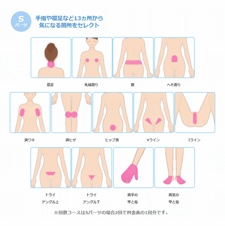ミュゼフリーセレクト Sパーツ